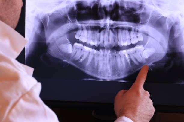 Best Emergency Tooth Extraction in Galatia, IL